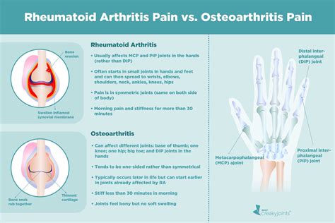 romatoid artrit osteoartrit